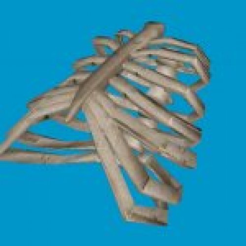 bt ribcage