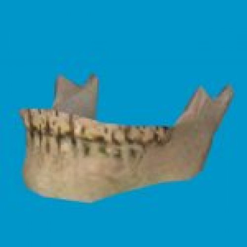 bt skull jaw