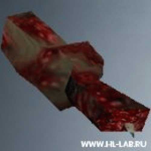 armymedicgibs.zip