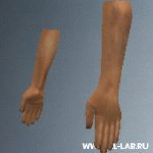 v_arms