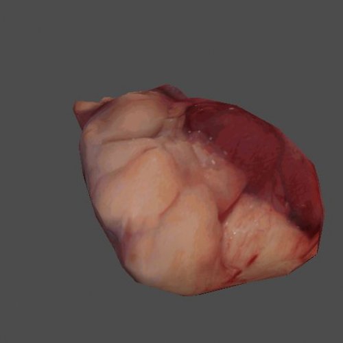 AF_heart