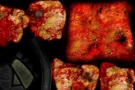 Gorey_Hands_V.2