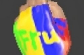 Wonderboy_Gloves