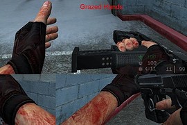 Grazed_Hands