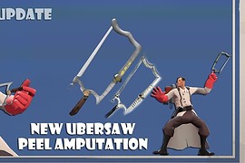 Peel amputation for medic