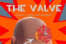 The Valve